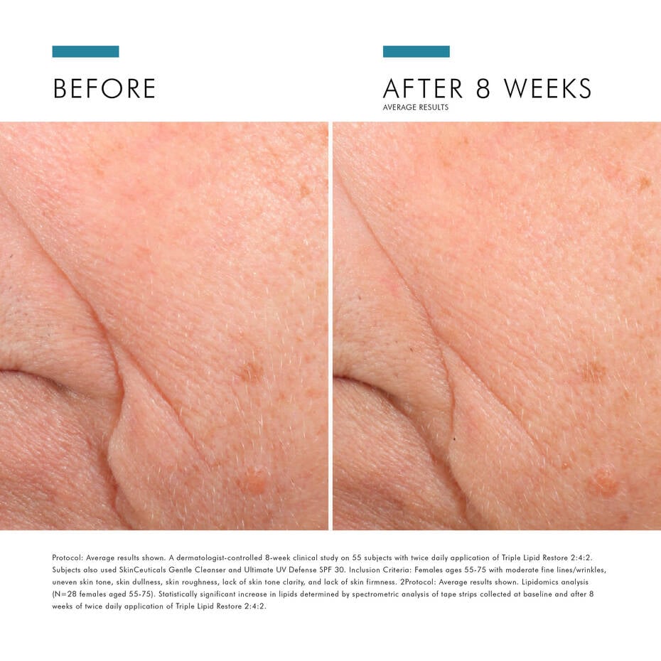 SkinCeuticals Triple Lipid Restore 2:4:2 | Authorized Retailer in Mississauga - Beauty image 7