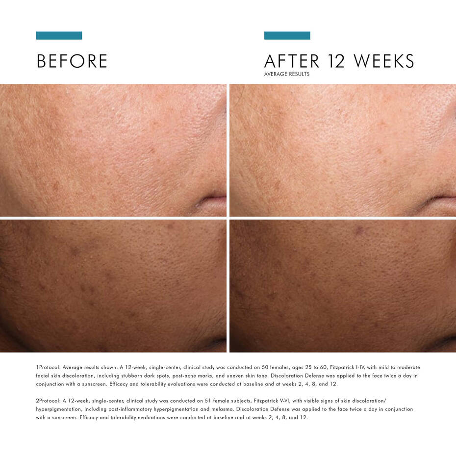 SkinCeuticals Discoloration Defense® – Advanced Dark Spot Corrector - Beauty image 9