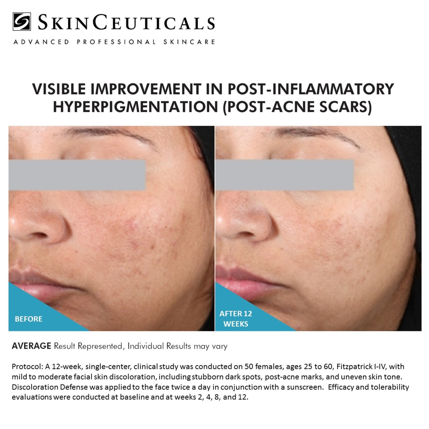 SkinCeuticals Discoloration Defense® – Advanced Dark Spot Corrector - Beauty image 3