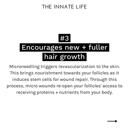 MAX. HAIR GROWTH BUNDLE - Kitchen & Dining image 9