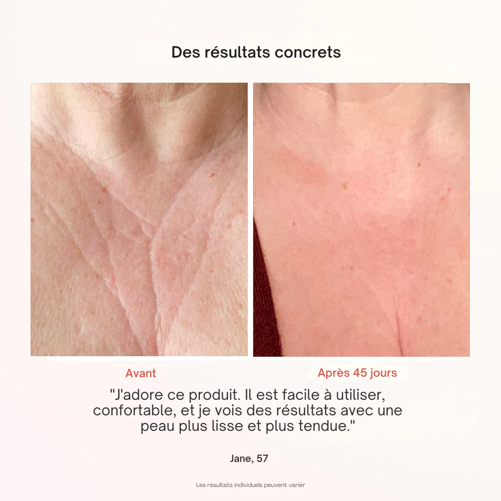 Masque Professionnel de Photothérapie - Misc image 14