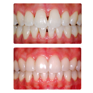 2 Day Bioclear Program - Lecture & Hands-On - Misc image 3