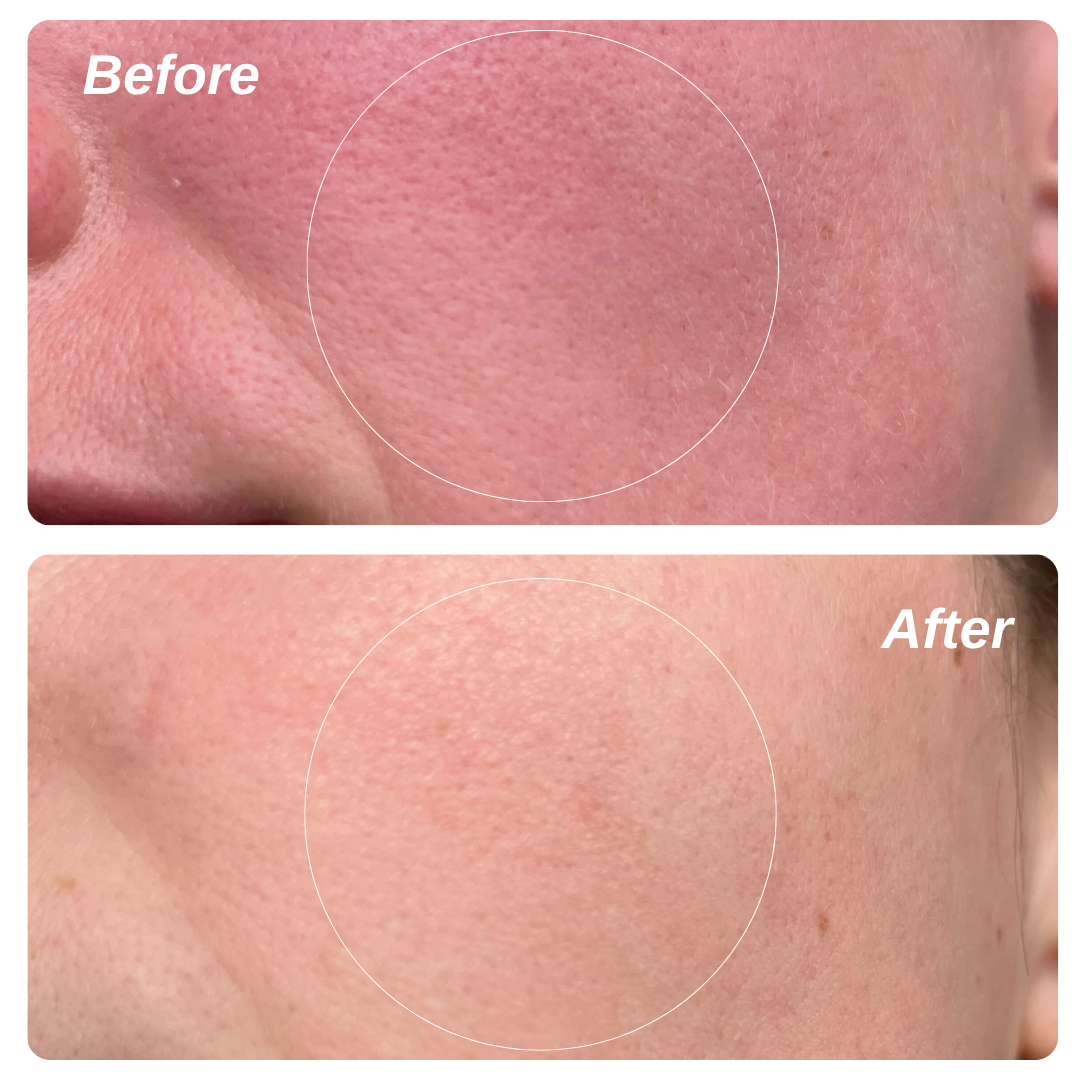 Ruddi Redness Control 1.7oz (50ml) - Kitchen & Dining image 5