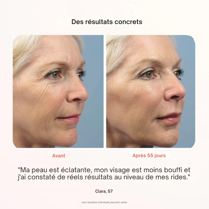 Masque Professionnel de Photothérapie - Misc image 4