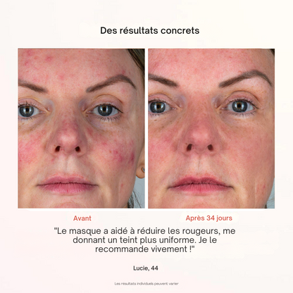 Masque Professionnel de Photothérapie - Misc image 12