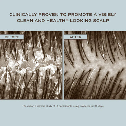 Hair Renew Scalp Hairbath - Misc image 2