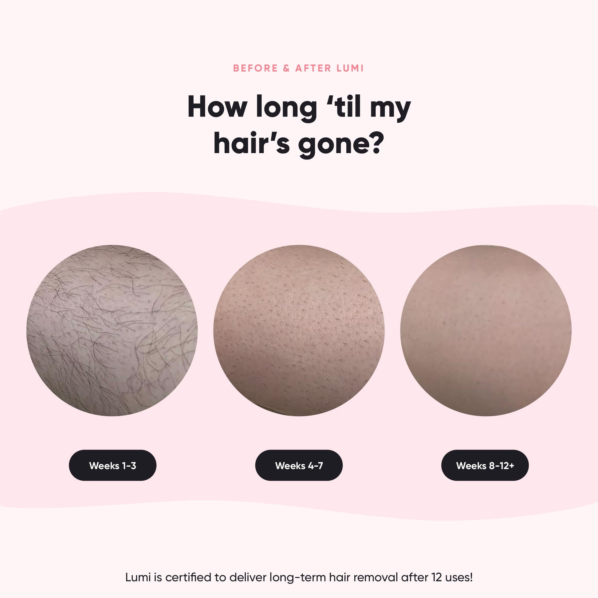 Silky Smooth+ Routine (Lumi + 4D + 2 Gloves + Lotion) - Misc image 8