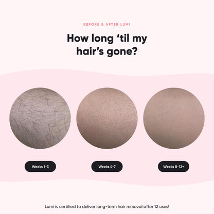 Silky Smooth+ Routine (Lumi + 4D + 2 Gloves + Lotion) - Misc image 8