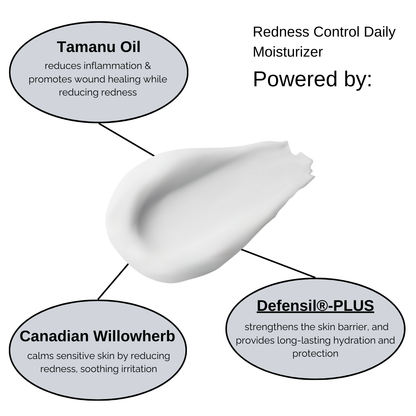 Sensitive Skin Essential Routine Bundle - Beauty image 5