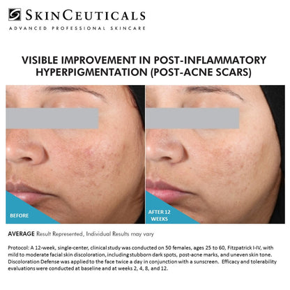 SkinCeuticals Discoloration Defense® – Advanced Dark Spot Corrector - Beauty image 3